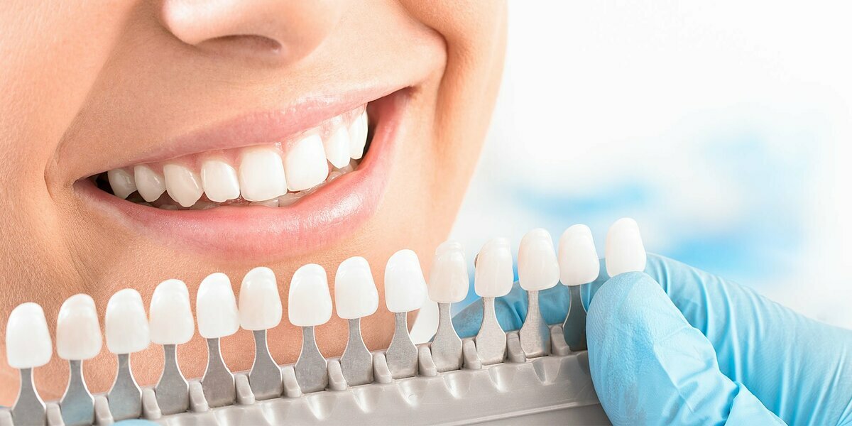 Можно ли отбелить зубы дома эффективно и безопасно?